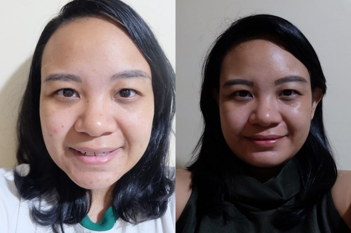 wanderwomomxbeautederm1