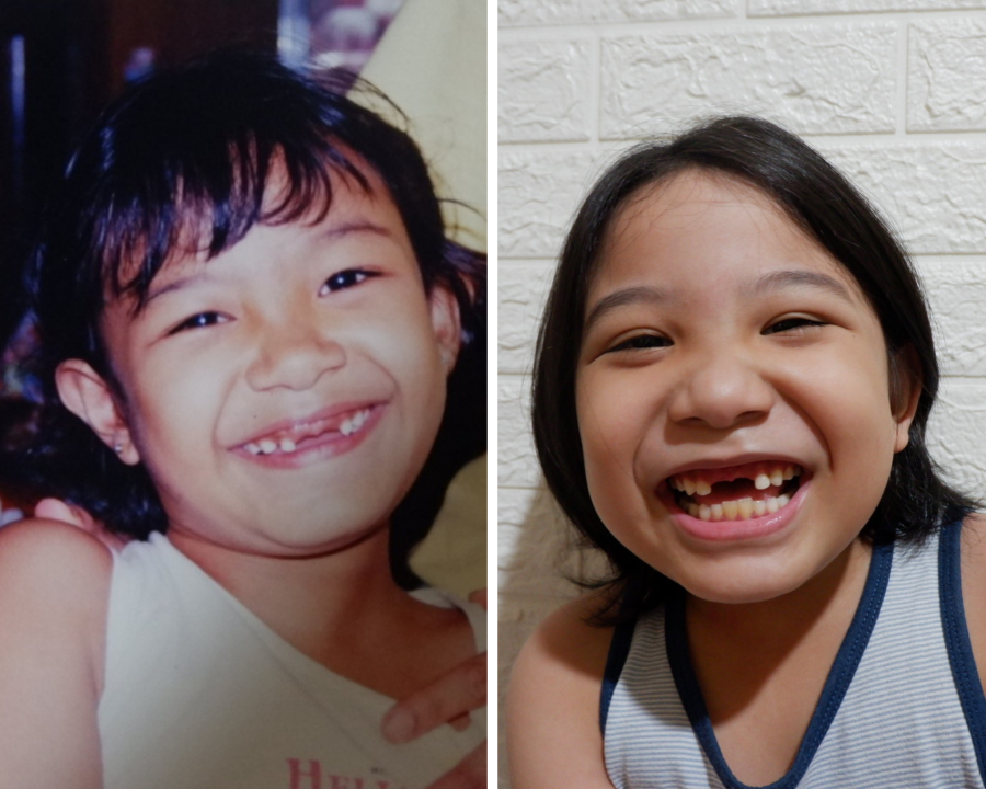 doubletoothlokalike2