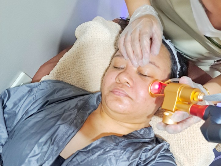 CO2 Fractional Laser